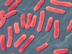Resultado de imagen para bacterias coliformes en alimentos