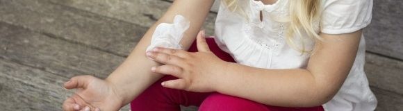Dermatitis atópica: la importancia de cuidar la piel